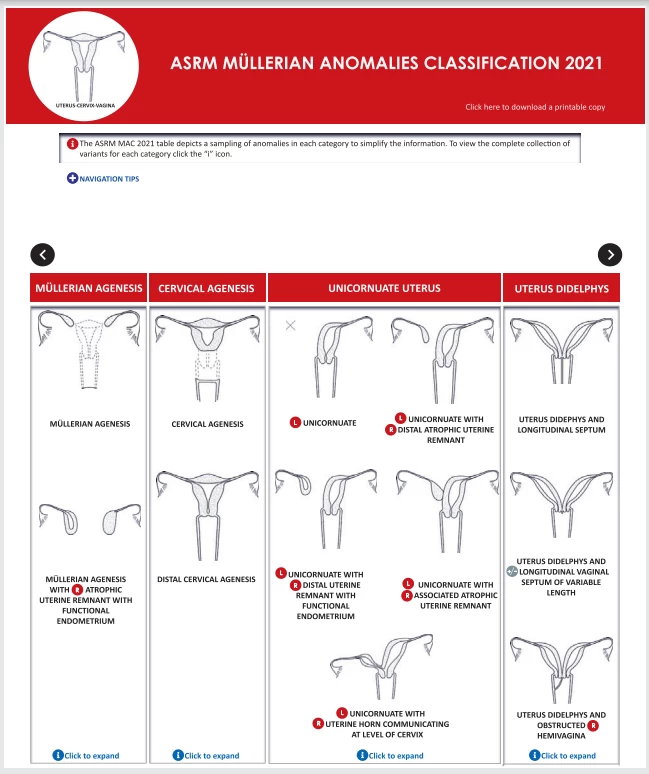 fig2-asrm-mullerian-anomalies.webp