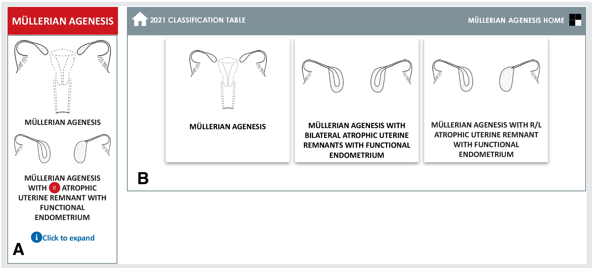 fig3-asrm-mullerian-anomalies.webp