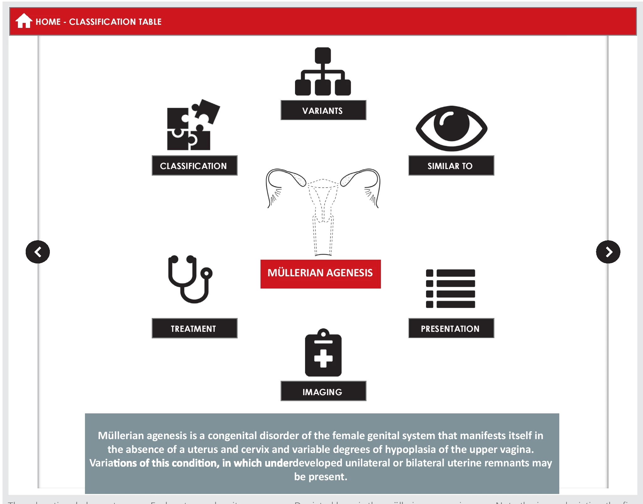 fig4-asrm-mullerian-anomalies.webp