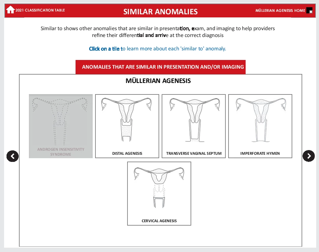 fig6-asrm-mullerian-anomalies.webp