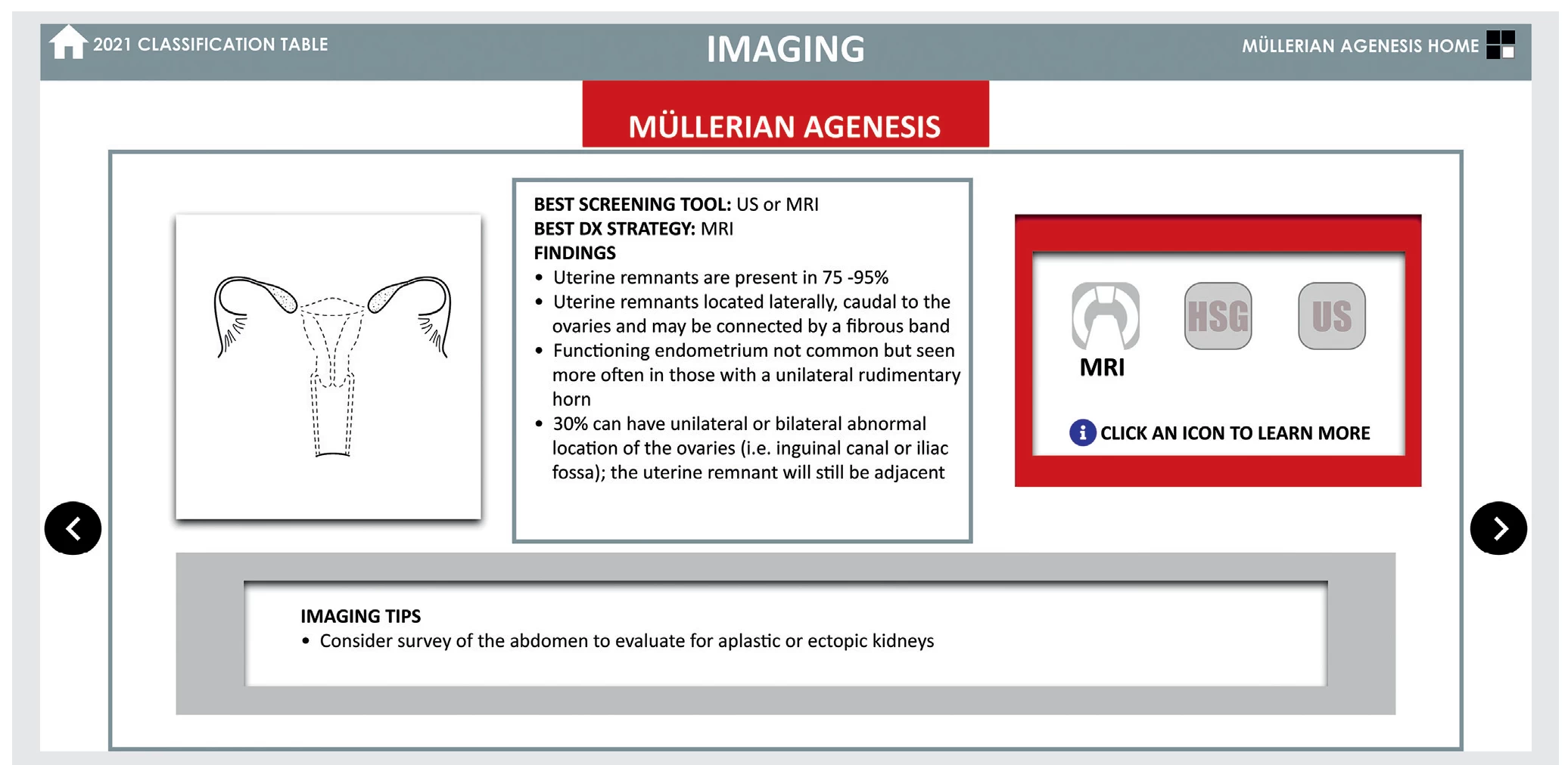 fig8-asrm-mullerian-anomalies.webp